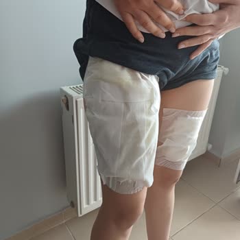 Termos Kapağı Fırladı Kızımın Bacakları Yandı Firma Ulaşılmaz Durumda