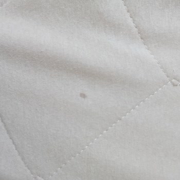 Formeya Aldığım Alezler Beklentimi Karşılamadı, Kalite Çok Düşük!