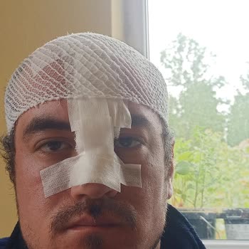 Diş Tedavisinde Yaşadığım Ciddi Sağlık Sorunları Ve Mağduriyet