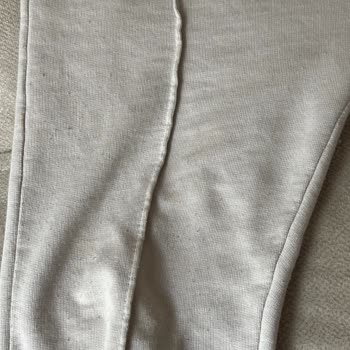 Yeni Alınan Çocuk Takımında Anormal Tüylenme Sorunu