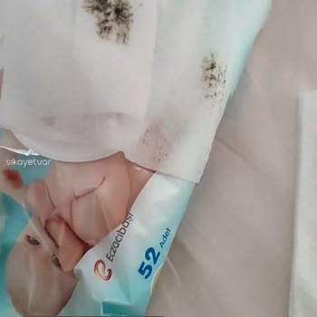 Uni Baby Islak Mendil Küflü!
