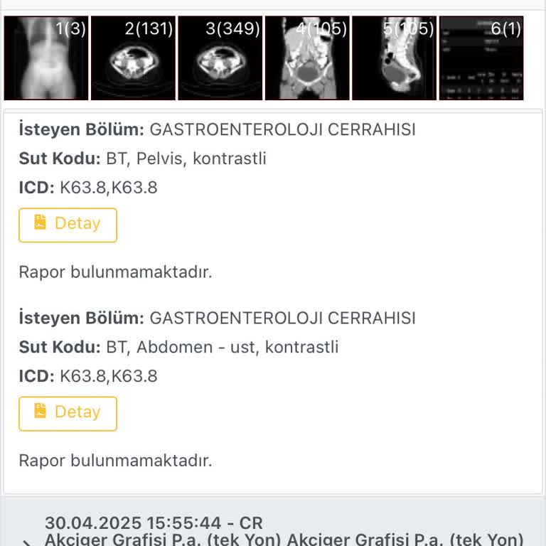 Tomografi Sonucu Gecikiyor, Randevularım Boşa Gitti