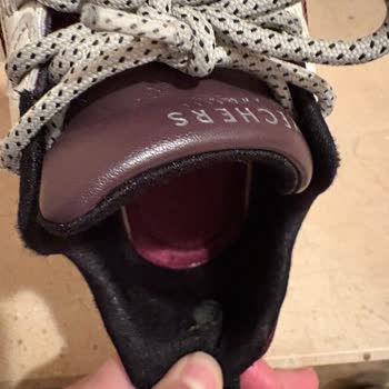 Skechers Ayakkabıda Erken Yıpranma Ve Müşteri Hizmetlerinde Hayal Kırıklığı