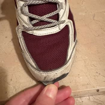 Skechers Ayakkabıda Erken Yıpranma Ve Müşteri Hizmetlerinde Hayal Kırıklığı