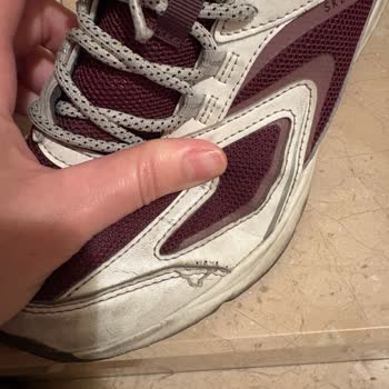 Skechers Ayakkabıda Erken Yıpranma Ve Müşteri Hizmetlerinde Hayal Kırıklığı