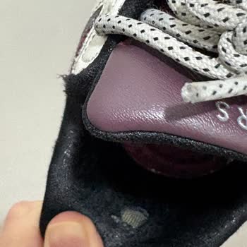 Skechers Ayakkabıda Erken Yıpranma Ve Müşteri Hizmetlerinde Hayal Kırıklığı