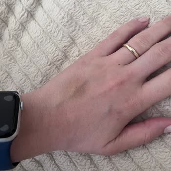 Damar Yolu Açmada Yetersiz Hemşireler Yüzünden Mağduriyet