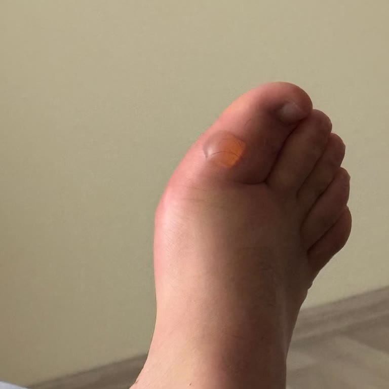 Aldığım Siyah Spor Ayakkabı Ayağımı Acıttı Ve Yara Yaptı