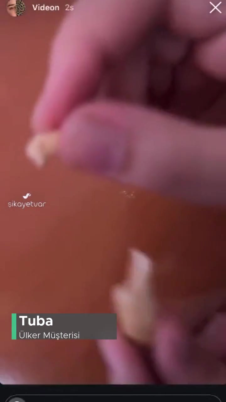 Ülker Ürün İçinden Kıl Çıktı videonun kapak resmi