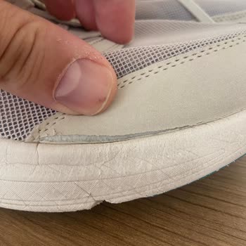 Skechers Az Kullanılan Ayakkabıda Açılma Ve Garanti Sürecinde Mağduriyet