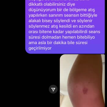 Lazer Epilasyon Sonrası Yanık Ve Merkezin İlgisiz Davranışı