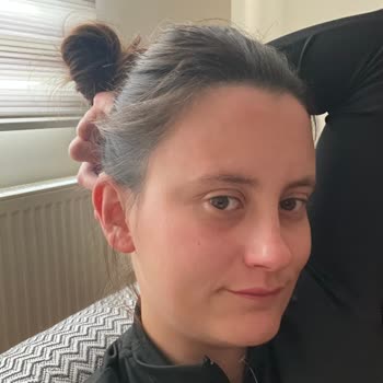 Güneş Kremi Cildimde Alerjik Reaksiyona Ve Yanıklara Sebep Oldu