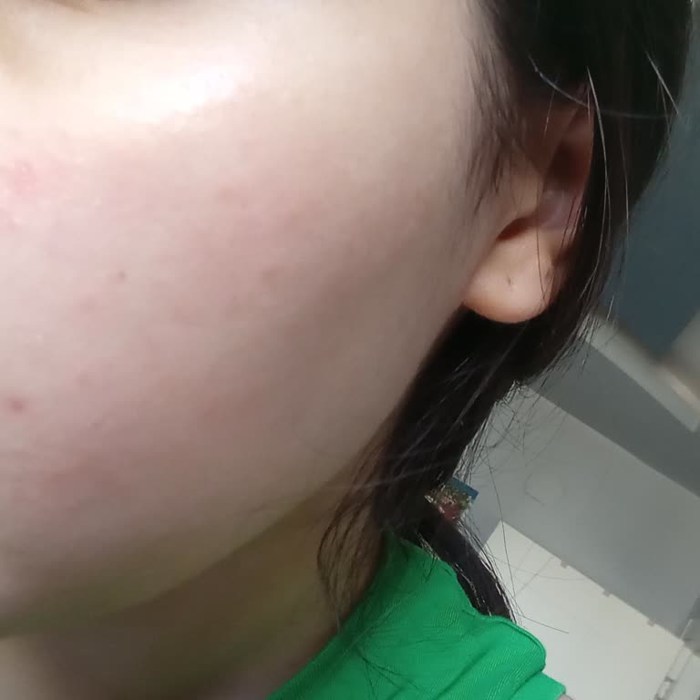 Dalin Teen Yüz Nemlendiricisi Cildimi Yaktı Ve Yapış Yapış Hissettirdi