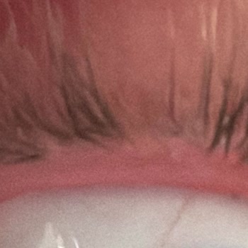 Cansay Nail Beauty Hatalı İpek Kirpik Uygulaması Sonrası İlgisizlik ve Sağlık Sorunu