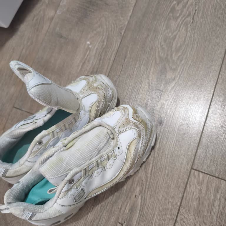 Skechers Ayakkabıda Kısa Sürede Deformasyon Ve Garanti Sorunu Yaşadım