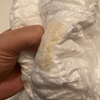 Molfix Bebek Bezinde Sert ve Hijyenik Olmayan Parça İle Karşılaştım