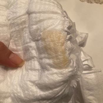 Molfix Bebek Bezinde Sert ve Hijyenik Olmayan Parça İle Karşılaştım