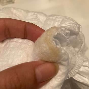 Molfix Bebek Bezinde Sert ve Hijyenik Olmayan Parça İle Karşılaştım