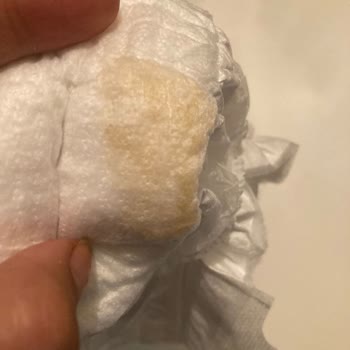 Molfix Bebek Bezinde Sert ve Hijyenik Olmayan Parça İle Karşılaştım