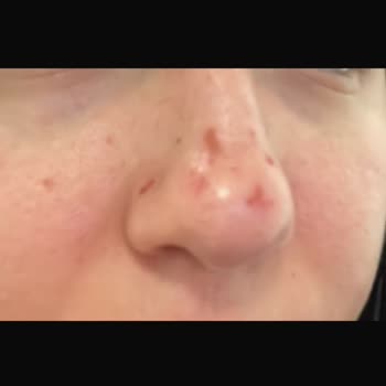 Arven Güzellik Cilt Bakımı Diye Cildimi Mahvetti