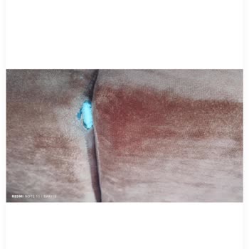 Vivense'den Gelen Defolu Koltuklar Ve 1.5 Yıldır Çözülemeyen Değişim Sorunu