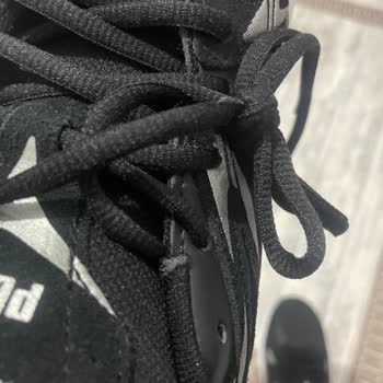 Kusurlu Ürün Ve Eksik Stok Bilgisi Nedeniyle Mağduriyet Yaşadım