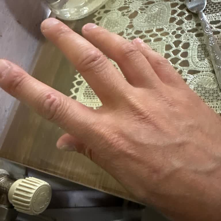 Termosun Eksik Aparatı Yüzünden Yanık Ve Mağduriyet