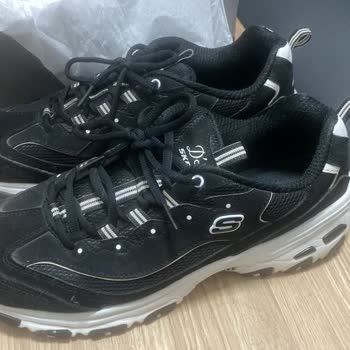 Garanti Sürecinde Red Edilen Skechers Ayakkabı Sorunu