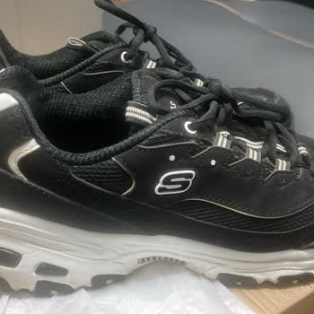 Garanti Sürecinde Red Edilen Skechers Ayakkabı Sorunu