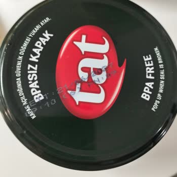 Garnitürden Taş Çıktı, Sağlığımız Tehlikede!