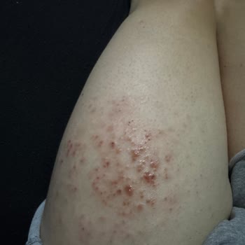 Aldığım Tüy Dökücü Krem Cildimde Leke Ve İz Bıraktı, Çalışanlar Yanlış Bilgilendirdi