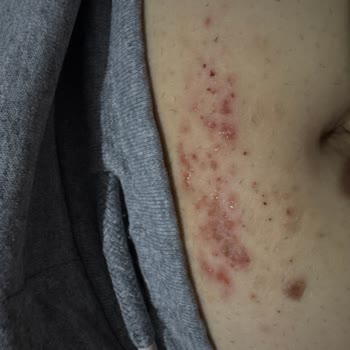 Aldığım Tüy Dökücü Krem Cildimde Leke Ve İz Bıraktı, Çalışanlar Yanlış Bilgilendirdi