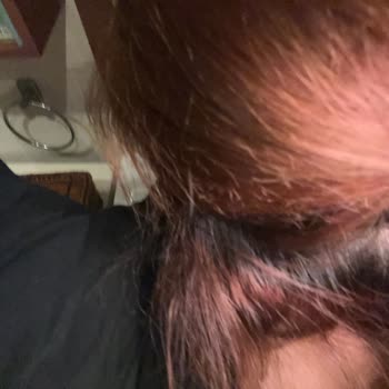 Saç Boyama Sonrası İstenmeyen Renk Ve Saç Hasarı Yaşadım