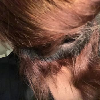 Saç Boyama Sonrası İstenmeyen Renk Ve Saç Hasarı Yaşadım