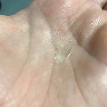 Dondurmanın İçinden Çıkan Plastik Parçalar Sağlığımızı Tehlikeye Attı