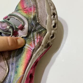 Kısa Sürede Deforme Olan Çocuk Ayakkabısına Çözüm Bekliyorum