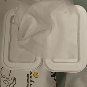 Küflü Islak Mendil Alerji Yaptı, Müşteri Hizmetlerine Ulaşamıyorum