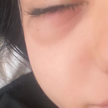 Hastanede Yetersiz Muayene, Dinlenmeyen Hasta