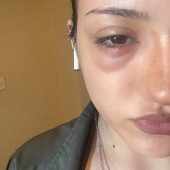 Hastanede Yetersiz Muayene, Dinlenmeyen Hasta