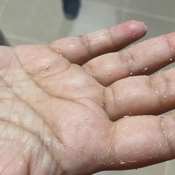 Bioderma Güneş Kremi Cildimde Pütürlenme Ve Olumsuz Etki Yaptı, Dönüş Alamadım