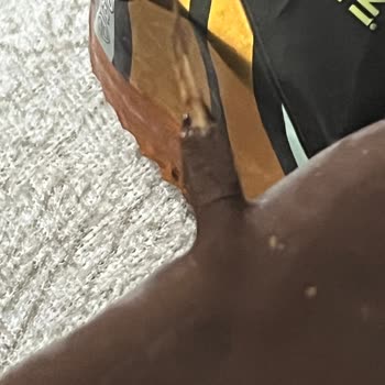 Magnum Dondurmada Yabancı Cisimle Karşılaştım