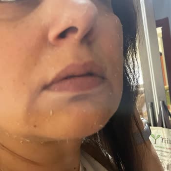 Satın Aldığım Güneş Kremi Cildimde Olumsuz Etki Yarattı Ve N11'den Geri Dönüş Alamadım