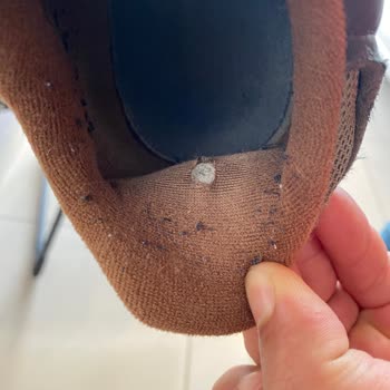 Lacoste Ayakkabıda Kısa Sürede İç Astar Delinmesi Ve Olumsuz İnceleme Sonucu
