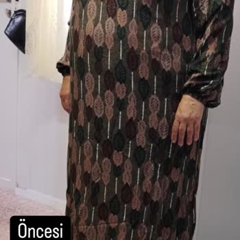 Yıkanınca Çekilen Elbise İçin Destek Alamadım Mağdur Oldum