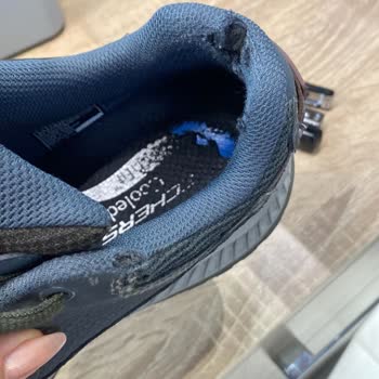 Skechers Ayakkabımın Topuğu Kısa Sürede Deforme Oldu Garanti Reddedildi!