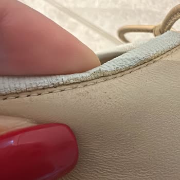 Ayakkabılarım Bakıma Gönderildi, Kullanılamaz Halde Geri Geldi!