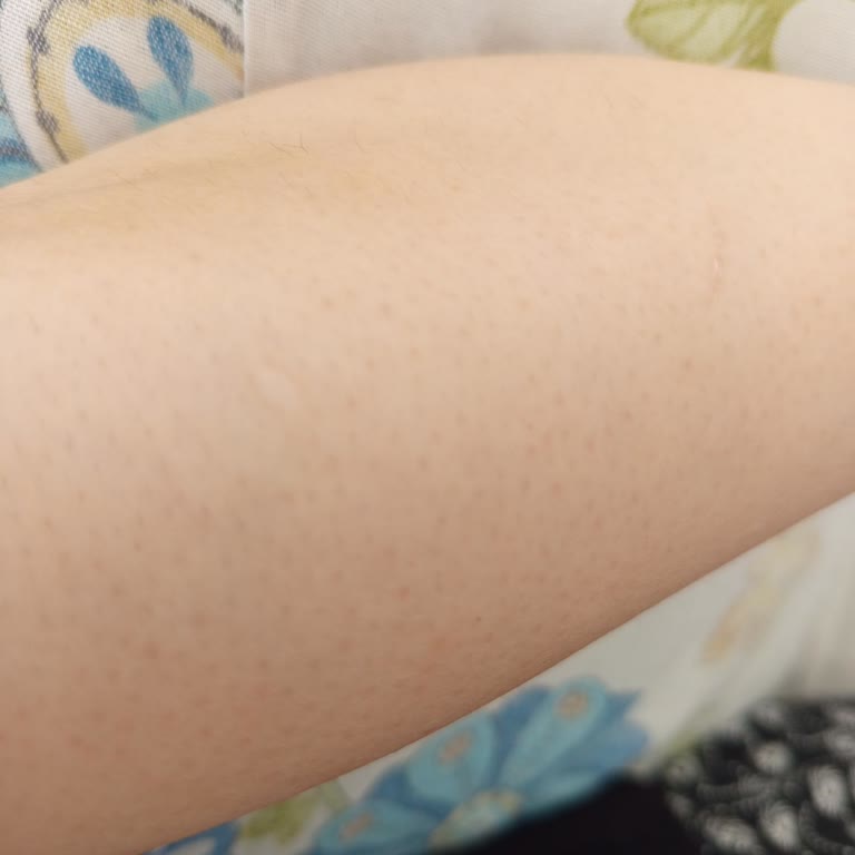 Kullanılmayan Seanslarım Ve Mağduriyetim Giderilmiyor