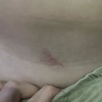 Linnas Hareket Merkezi İle Yaşadığımız Acı Tecrübe!