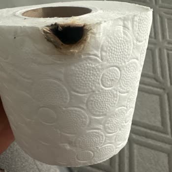 Familia Tuvalet Kağıdında Sigara İzmaritiyle Yanık Ve Hijyen Endişesi