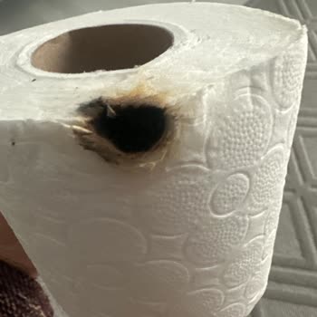 Familia Tuvalet Kağıdında Sigara İzmaritiyle Yanık Ve Hijyen Endişesi